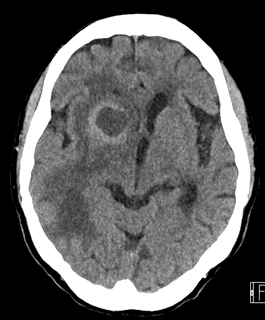 Hong Kong College Of Radiologists Case Of January