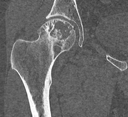 Hong Kong College Of Radiologists: Answer of July 2018