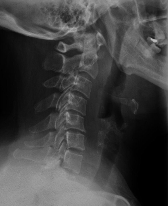 Hong Kong College Of Radiologists: Answer of December 2015