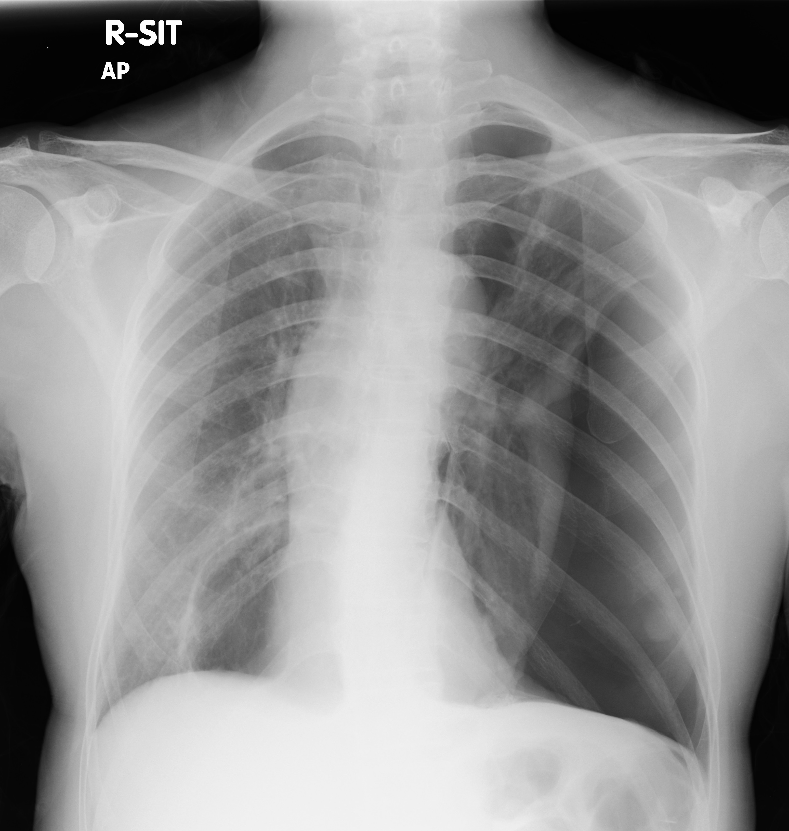 Hong Kong College Of Radiologists: Answer of November 2016